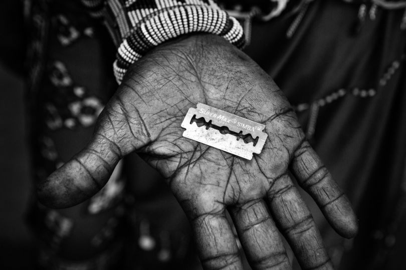 The operation will be done by a local woman, using a razor blade. © Meeri Koutaniemi / Helsingin Sanomat