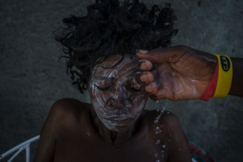 A cholera patient bathed with soap and water mixed with Clorox in 2016 in Haiti © Meredith Kohut