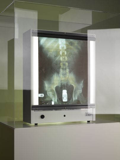 ©Scheltens Abbenes, Butt X-Ray, Jackass (2002)